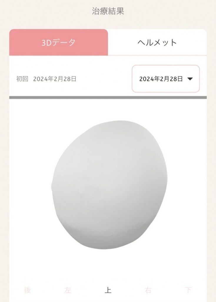 治療前の3Dデータ(上)